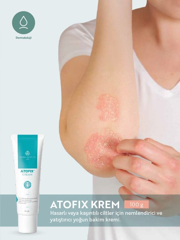 Alpinia ATOFIX KREM 100g